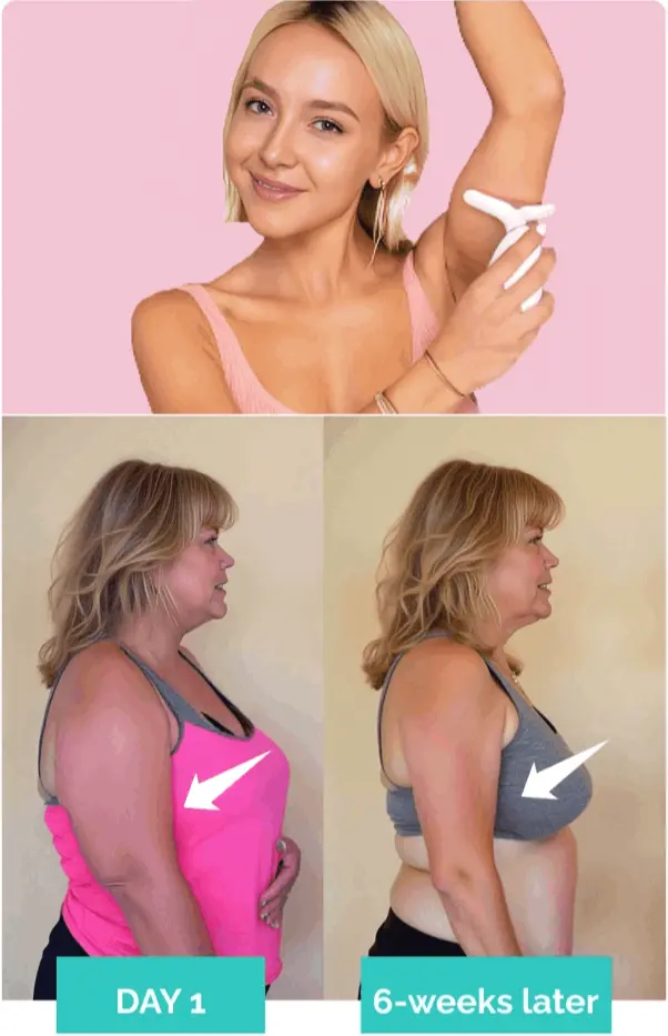What is My Derma Dream Red Light Therapy